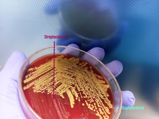 Colonies of bacteria in petri dish (blood agar), mixed bacterial colonies. Streptococcus and...