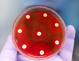 Antimicrobial susceptibility testing in blood agar media, antibiotic sensitivity