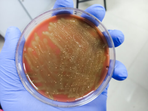 Mixed colony in Chocolate agar media, Stresptococcus colonies, Gram positive bacteria colonies as test on chocolate agar plate.