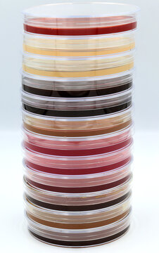 Columna de medios de cultivo selectivos utilizados en microbiolog&iacute;a para el aislamiento de hongos, levaduras o bacterias