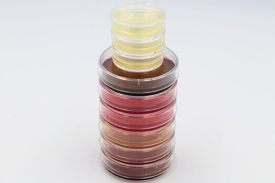 Placas peque&ntilde;as utilizadas en el laboratorio de Microbiolog&iacute;a para el aislamiento de microorganismos