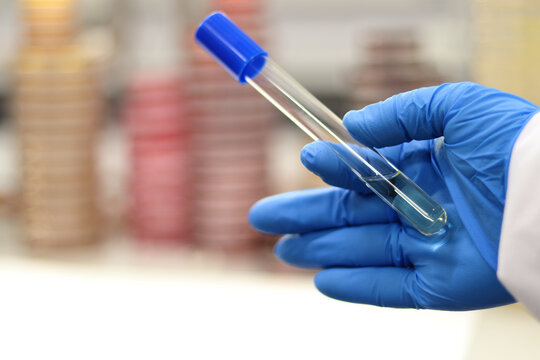 Tubo de ensayo para experimentos en el laboratorio de investigaci&oacute;n