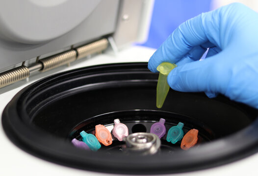 Centr&iacute;fuga de tubos utilizada en el laboratorio cl&iacute;nico o de investigaci&oacute;n