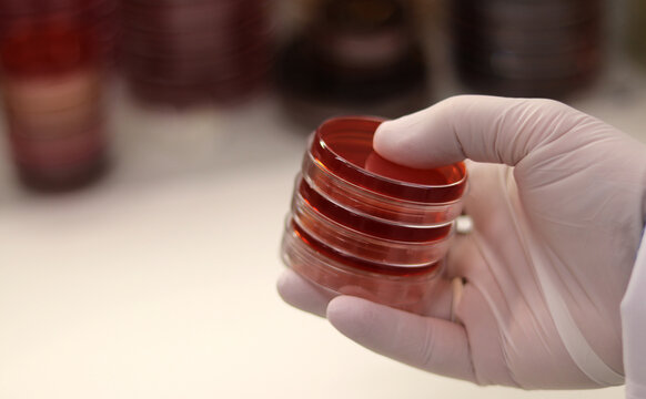 Placas de cultivo microbiol&oacute;gico para el laboratorio de investigaci&oacute;n
