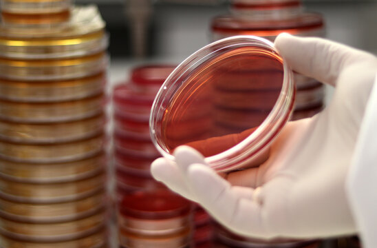 Mano de m&eacute;dico o cient&iacute;fico sujetando una placa de Petri para el cultivo de microorganismos