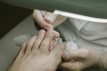 sore toenails of the patient the doctor examines under the lamp