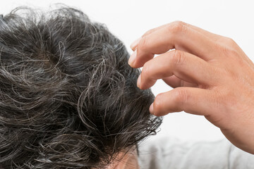 白髪交じりの中年男性の頭