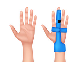 Plastic two sided finger splint with two convenient hook and loop straps on an broken middle finger. Holding a finger straight with orthopedic tool. isolated on white background. 3D vector EPS10.