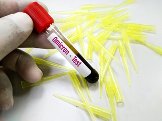 Omicron positive, blood sample tube positive with Omicron or B.1.1.529 variant of COVID-19...