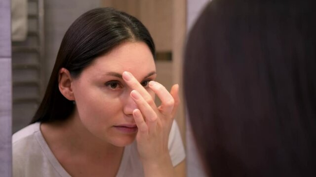 The girl looks in the mirror at the pimples on her face. Problem areas of the skin, dermatology