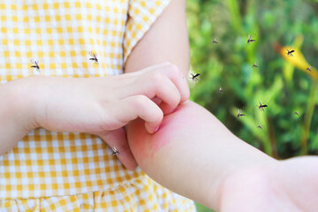 Little girl has skin rash allergy and itchy on her arm from mosquito bite