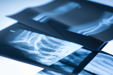 Closeup of different x-ray images - obrazy, fototapety, plakaty
