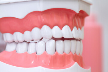 Model of the upper and lower jaw with white teeth for medical professionals and for teaching students about the treatment, prosthetics and orthodontics of students.
