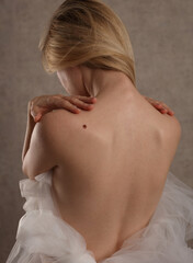 Checking benign moles : Beautiful Woman with birthmark on her back. Laser skin tags removal