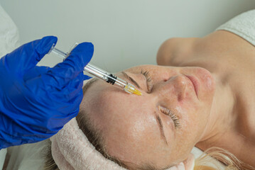 Close-up of a cropped image of a doctor's hands doing facial mesotherapy on a beautiful woman.