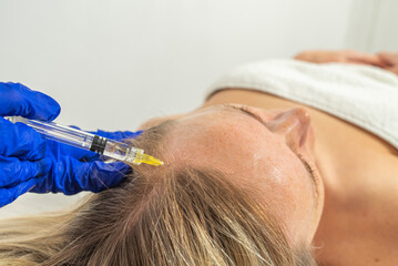 Mesotherapy procedure. A cosmetologist does a mesotherapy procedure in a woman's head. Strengthening hair and their growth