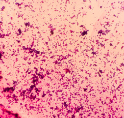 Gram staining, It is a method of differentiating bacterial species into two large groups(Gram-positive and Gram-negative), show gram positive blue color and gram negative red color