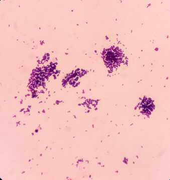 Gram staining, It is a method of differentiating bacterial species into two large groups(Gram-positive and Gram-negative), show gram positive blue color and gram negative red color