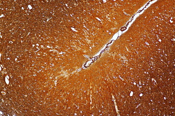 Motor Neuron and nerve cells under the microscope in Lab.