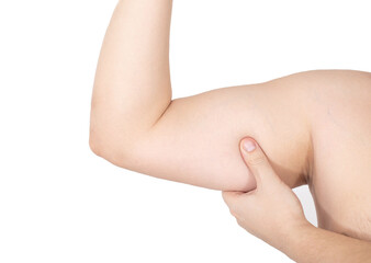 Human forearm biceps on white background, isolate. Muscle amyotrophy Concept. Rehabilitation for...