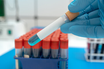 Test tube with empty label  to biological sample for medical laboratory research   on lab props background