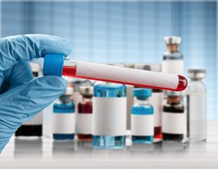 Researcher in analysis lab holding sample of new strain of Coronavirus Omicron.
