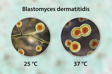 Blastomyces dermatitidis fungi