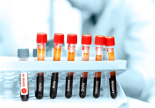 Test tubes with blood in the laboratory. Labeled covid-19 and mutation variants.