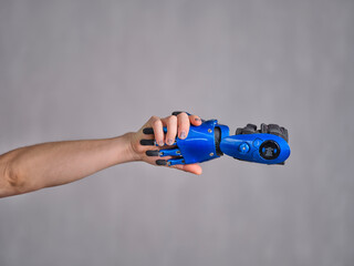  Handshake with prosthetic arm