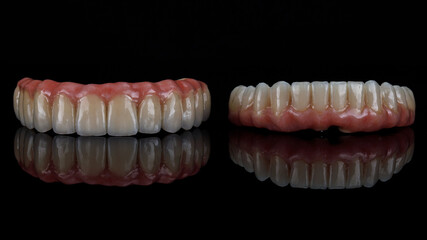 excellent composition on black glass dental ceramic prostheses with pink artificial gums