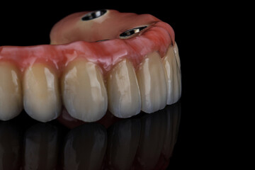 ceramic prosthesis of the upper jaw, macro photo on a black background with reflection