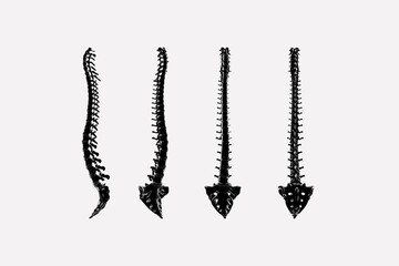 3d render of the spine and sacrum in different positions