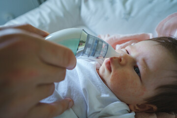 Side view on unknown woman mother using electric baby nasal aspirator mucus nose suction sucking the saliva from baby's nose cleaning while lying on the bed baby with atopic eczema