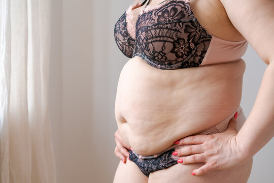 Fat woman, obese woman holds excessive belly fat in her hands. Concept reducing the abdomen and forming healthy abdominal muscles. Close-up photo, blurry.