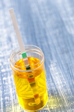 Conceptual image on urin alysis, dipstick placed on the vials of urine