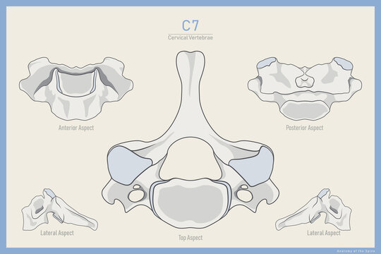 Anatomy of the 7th Cervical Vertebra. Vertebra Prominens C7. Anterior, Posterior, Lateral and Top View. Illustration for Education