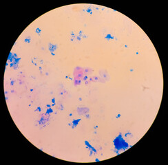 Microphotograph of squamous epithelial cell in gram stain, to identify gram positive and gram negative bacteria.