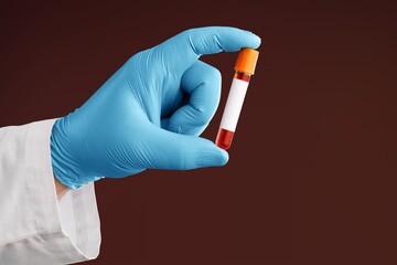 COVID-19 blood sample positive with coronavirus