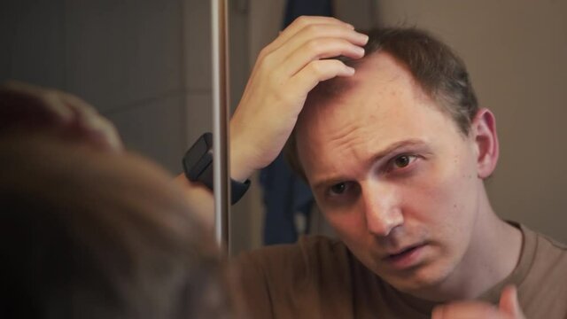 A young man with a bald patch on his head looks desperately at himself in the mirror