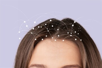 Dandruff problem. A girl with itchy head. Dandruff on the hair disease seborrhea. Fatty Dandruff.