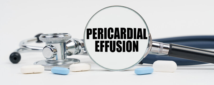 On a white surface are pills, a stethoscope and a magnifying glass inside which is written - Pericardial effusion