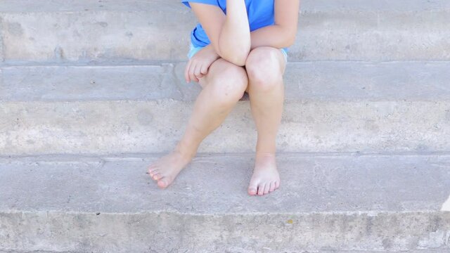 Children's feet itch and stand barefoot on cold concrete steps.