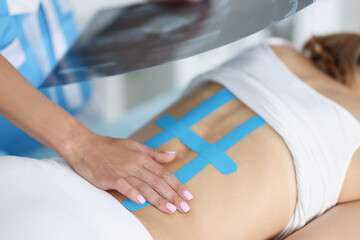 Woman doctor hold scan of woman back and correct kinesiology tape on females body - obrazy, fototapety, plakaty
