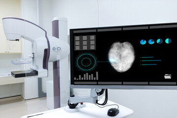 A mammogram machine showing breast cancer image on a computer monitor. - obrazy, fototapety, plakaty