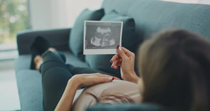 Young expecting female looking at pregnancy scan