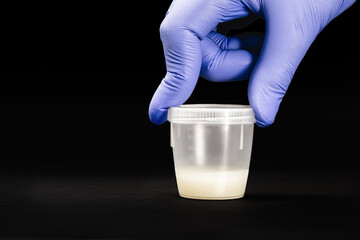 sample container, with semen for sperm culture, examination with the objective of evaluating the quality of the semen and detecting the presence of pathogenic agents