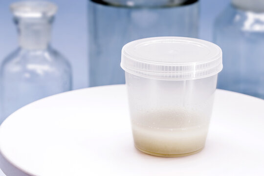 sample collection container, with semen for sperm culture, to detect the presence of pathogens