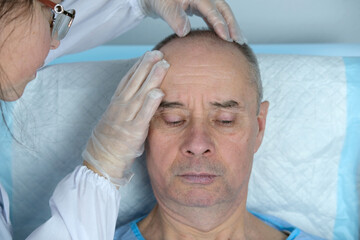 Obraz na płótnie Canvas Anti-aging treatments for balding men. Close-up trichologist in gloves examines patient, bald charismatic mature man with alopecia in hair growth clinic. concept of hair loss in men, selective focus