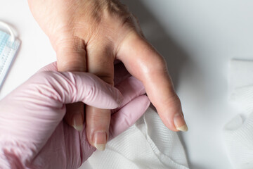 The doctor examines the injury of the female hand. Contusion of the middle finger of the right...