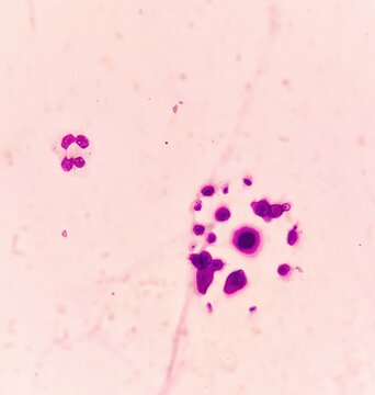 Encapsulated yeast in body fluid.